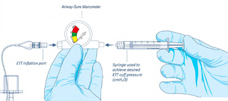 Cuff Pressure Manometer