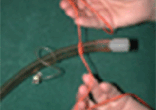 Endotracheal Tube Ties (Trinity Trach Tube Ties/ET Tube Ties)